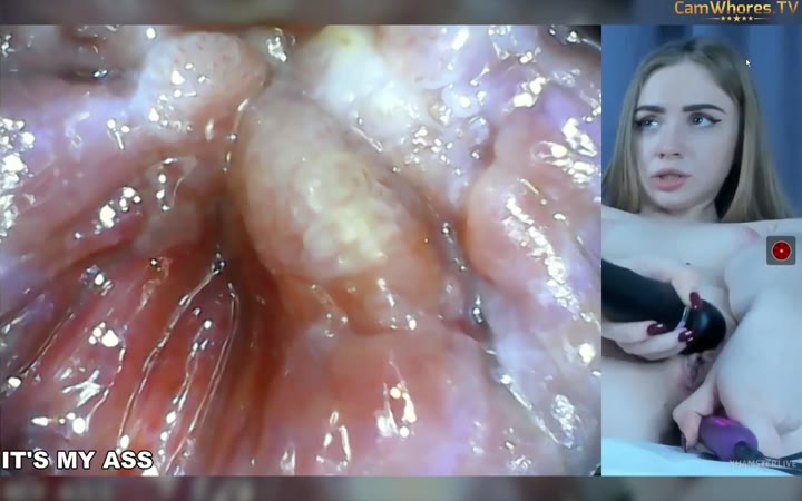 Watch YaYaGirls cam inside ass